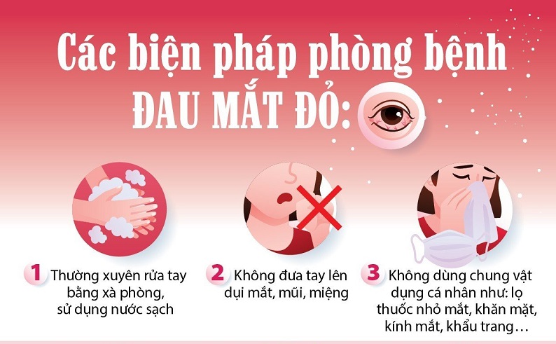 Tăng cường công tác phòng, chống bệnh đau mắt đỏ trên địa bàn tỉnh